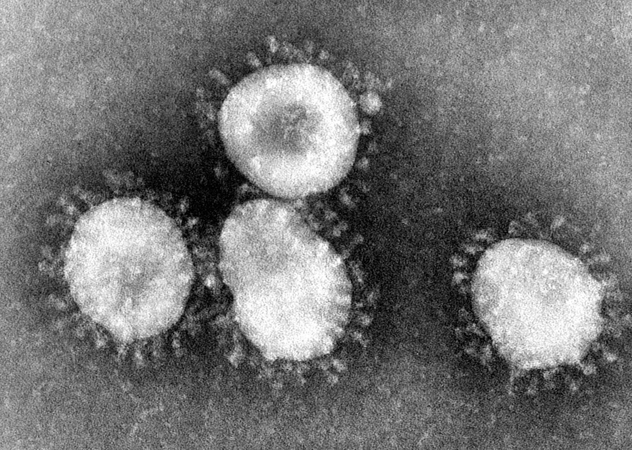 В Тверской области четвертый день не выявляются новые случаи коронавирусной инфекции