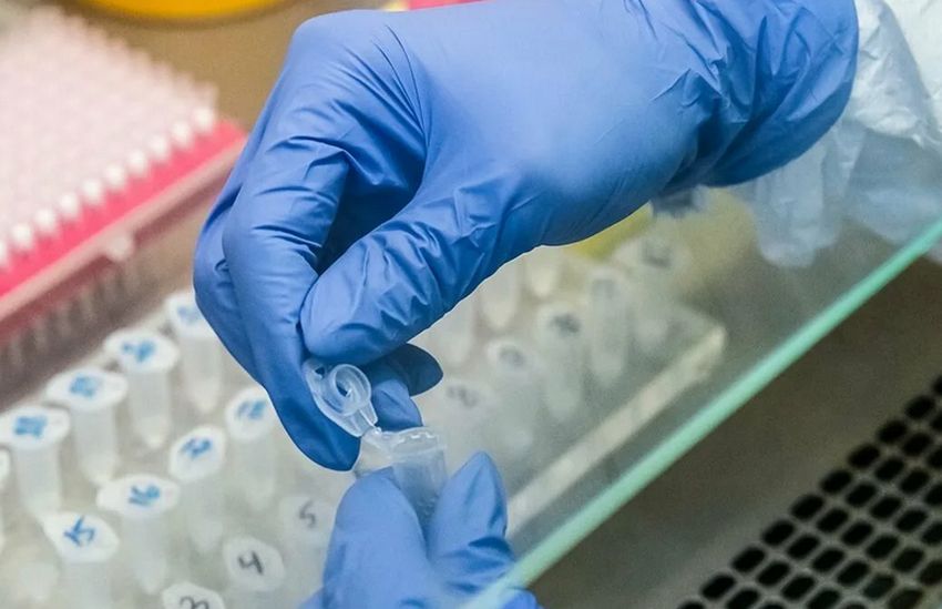 На коронавирус обследовали более 31 тысячи жителей Тверской области На коронавирус обследовали более 31 тысячи жителей Тверской области