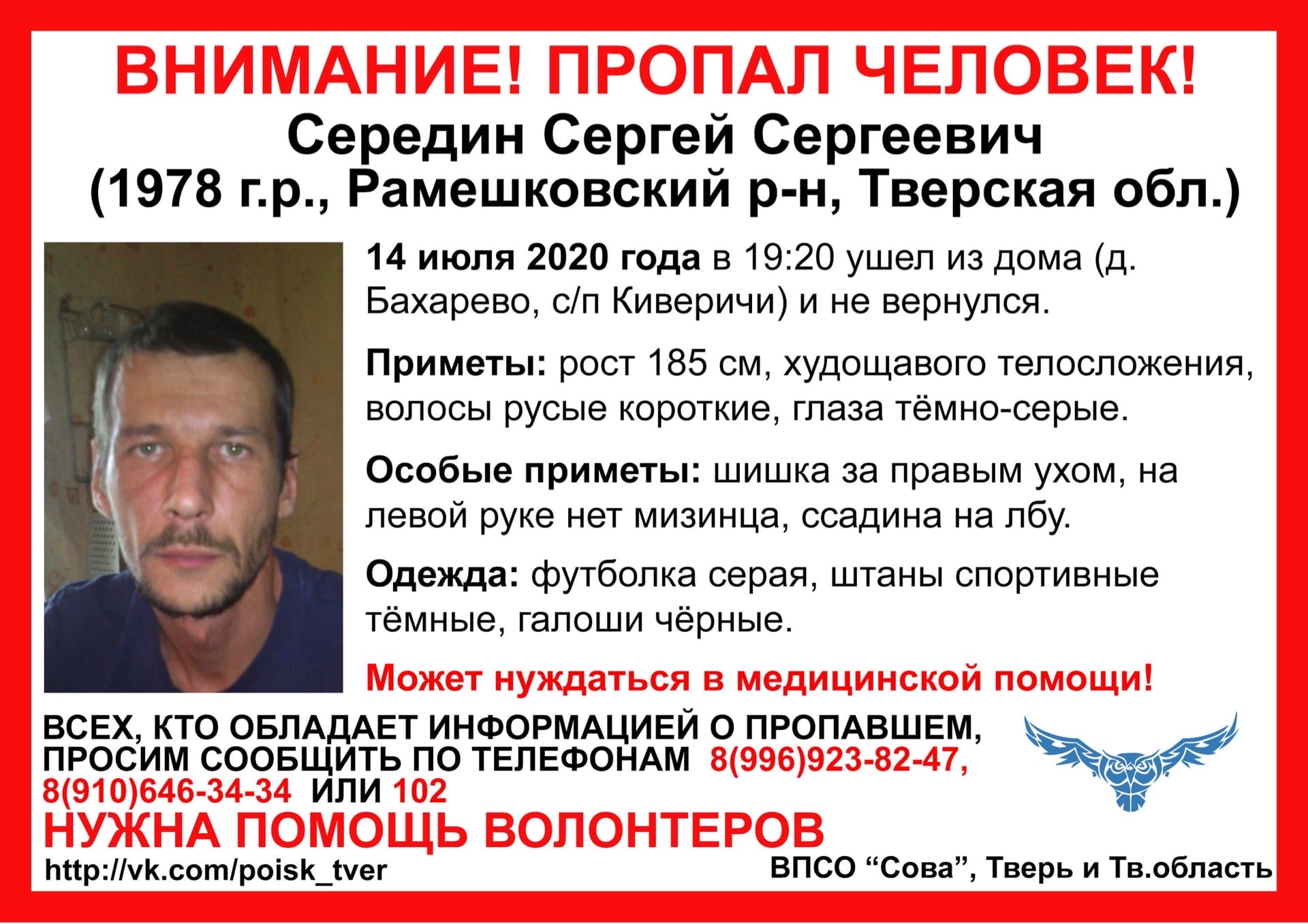 В Тверской области пропал мужчина без мизинца