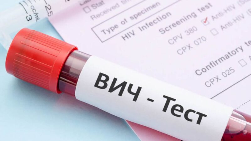 В Твери можно будет бесплатно узнать свой ВИЧ-статус В Твери можно будет бесплатно узнать свой ВИЧ-статус