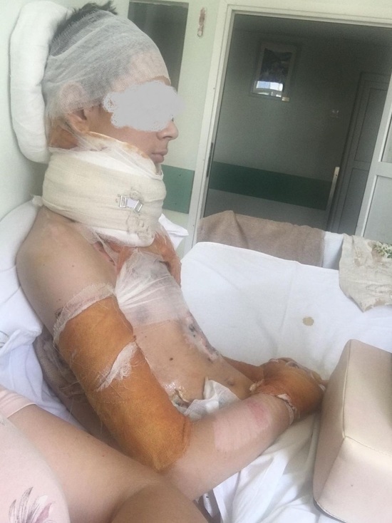 В Тверской области 14-летний мальчик чуть не сгорел в костре В Тверской области 14-летний мальчик чуть не сгорел в костре
