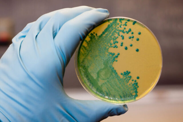 Лаборатория ветеринарной службы проводит исследования на листериоз