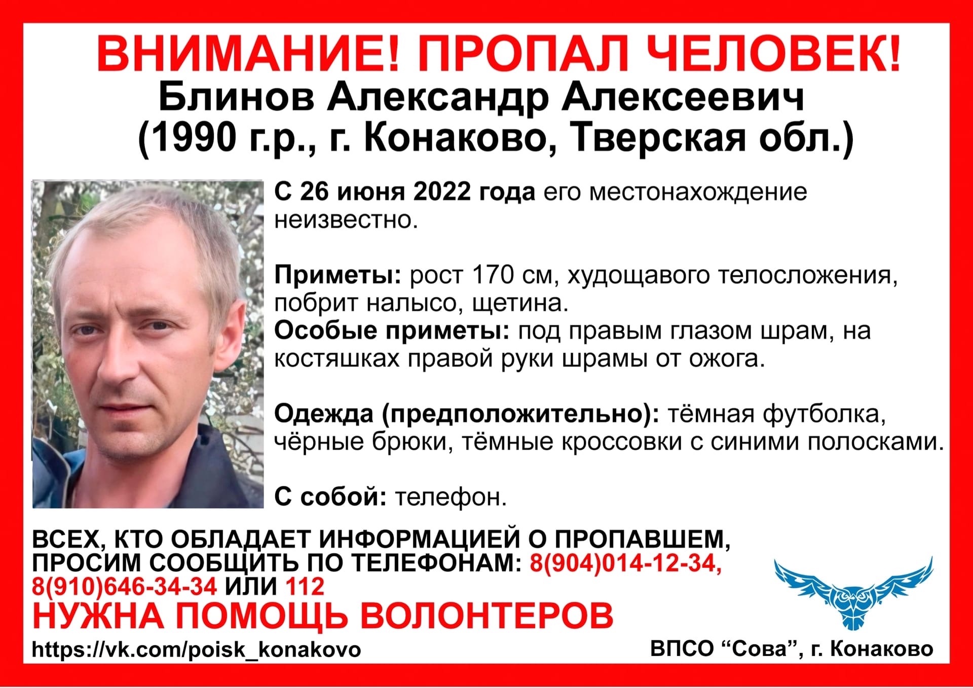 В Тверской области ищут мужчину со шрамом под правым глазом