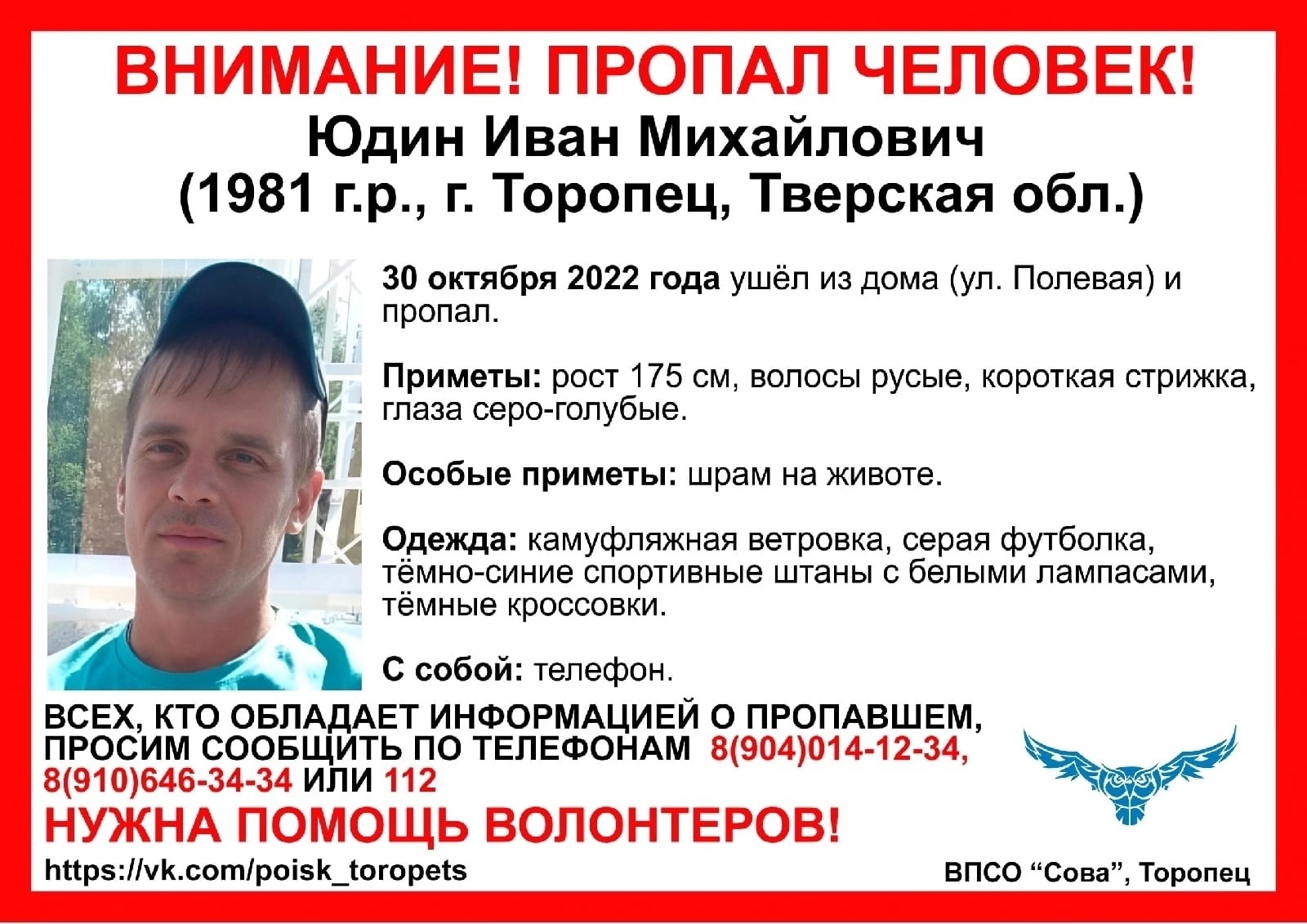 В Тверской области разыскивают 41-летнего мужчину со шрамом на животе