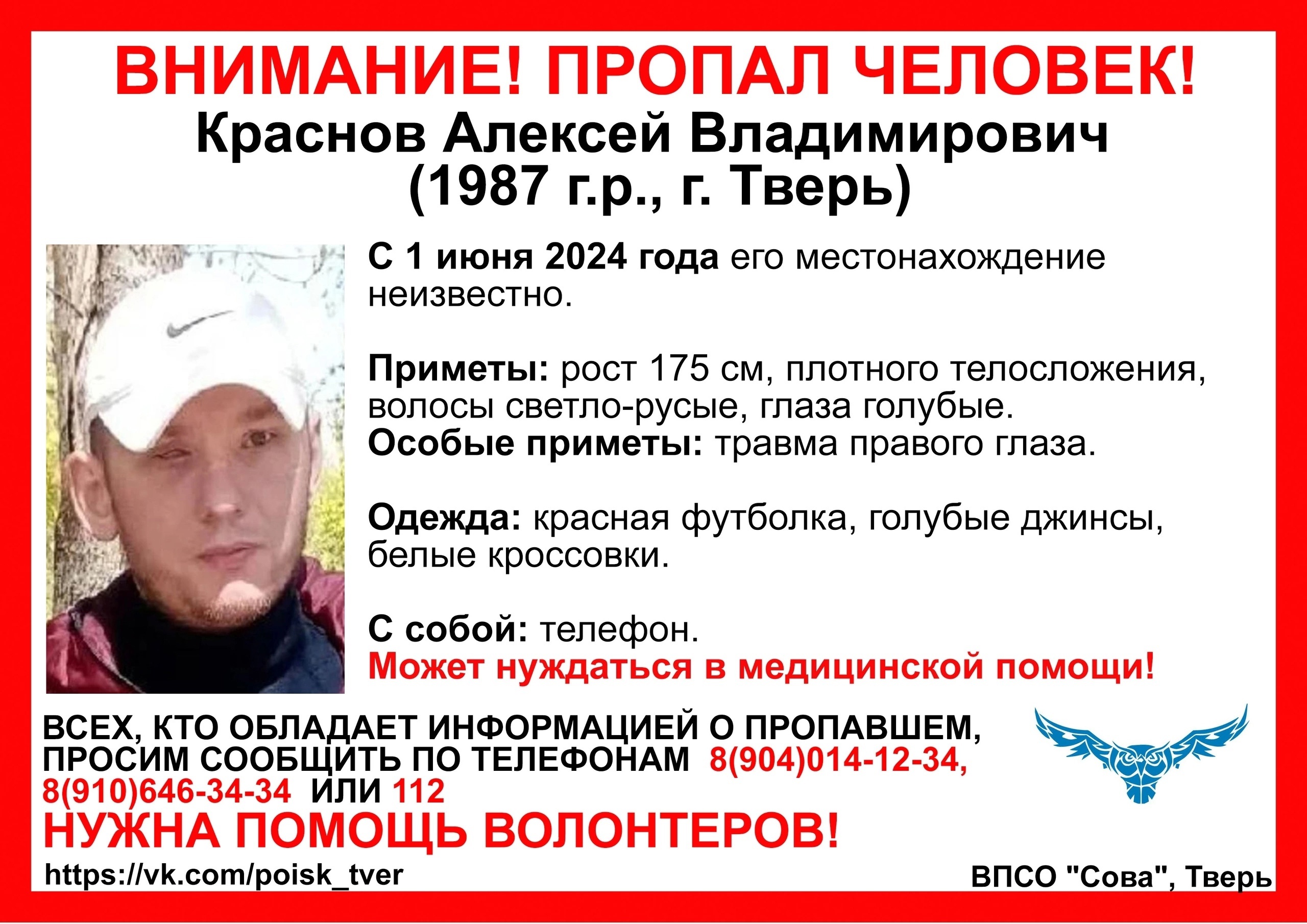 В Твери ищут мужчину с травмированным глазом