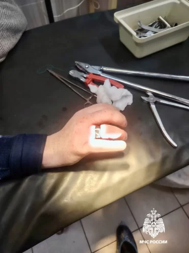 В Тверской области МЧС помогло мужчине снять кольцо В Тверской области МЧС помогло мужчине снять кольцо