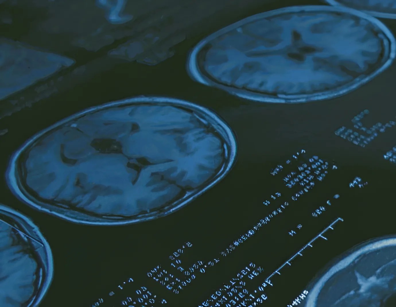 ИИ проанализировал 40 тысяч снимков пациентов в Тверской области